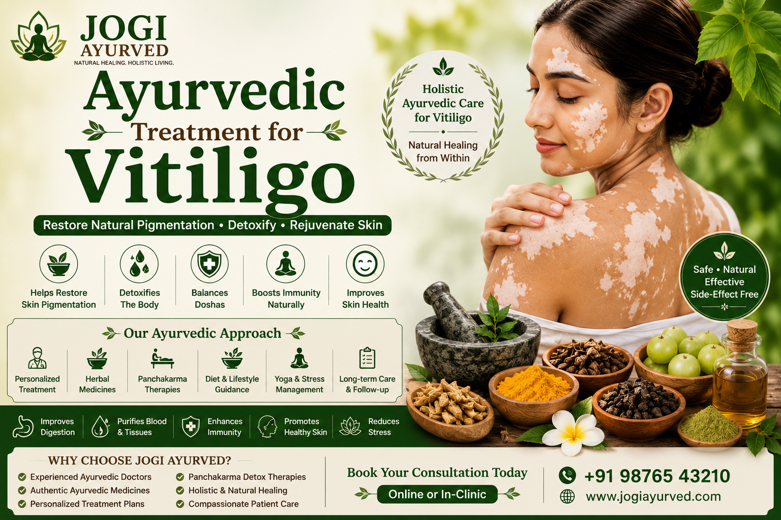 Ayurvedic Treatment for Vitiligo